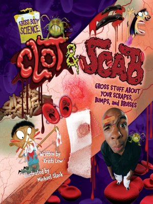 cover image of Clot & Scab